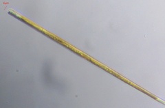 Ulnaria ulna aequalis