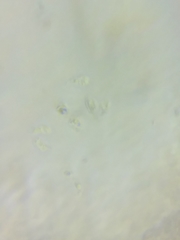 Resinomycena rhododendri
