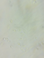 Resinomycena rhododendri