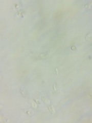 Resinomycena rhododendri