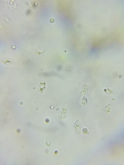 Resinomycena rhododendri