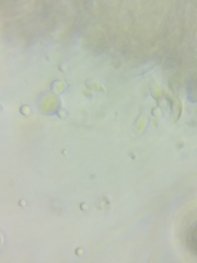 Resinomycena rhododendri