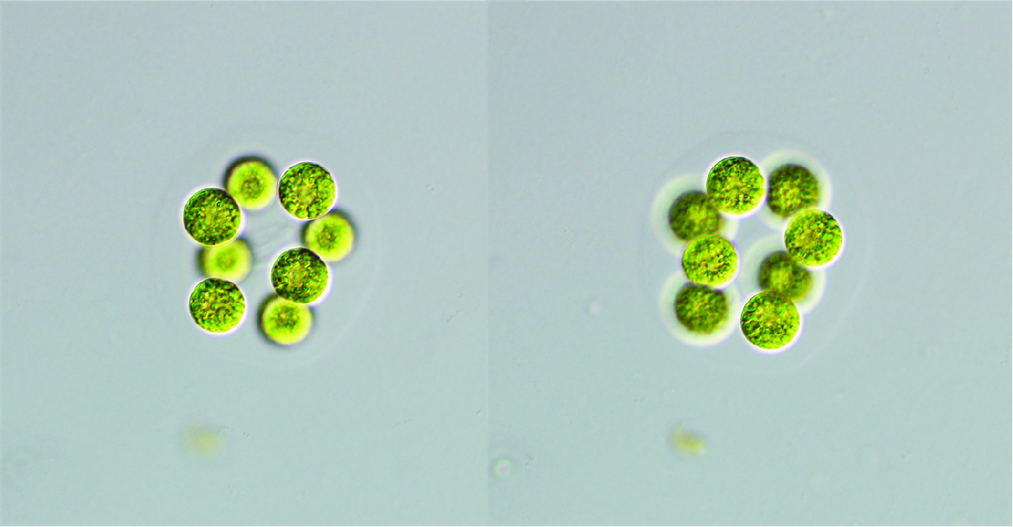 Radiococcus