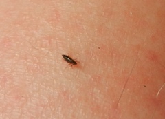 Siphonaptera