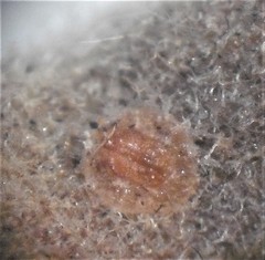 Lecanochiton actites