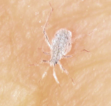 iNaturalist observation photo of Giant Aphids