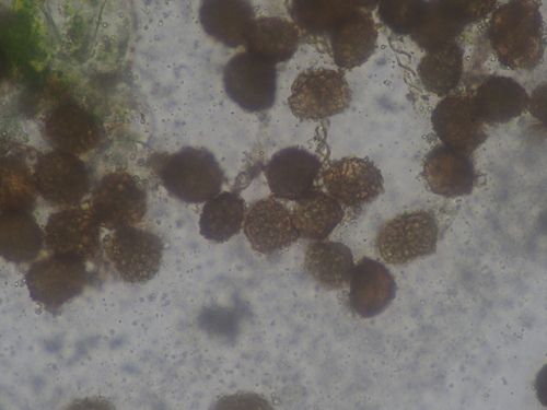 Image of Fossombronia foveolata by no rights reserved