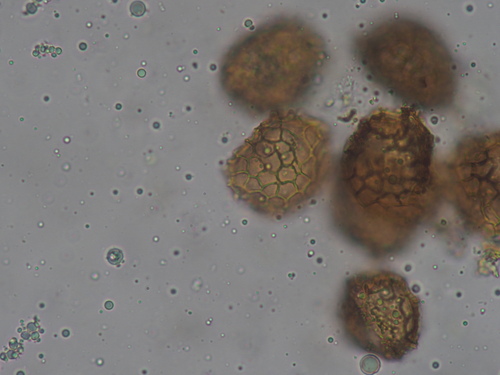 Image of Fossombronia foveolata by no rights reserved