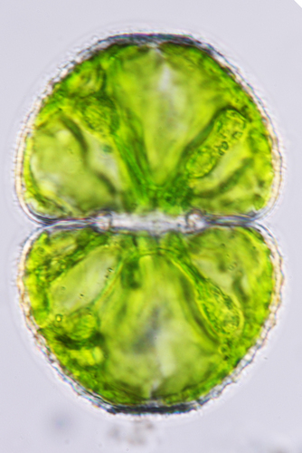 Cosmarium tetraophthalmum, 2024-09-20