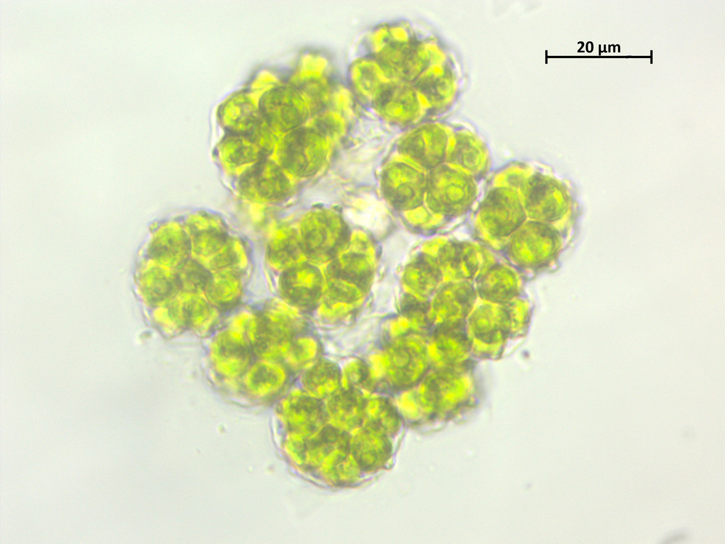 Coelastrum sphaericum (Coelastrum sphaericum)
