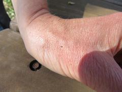 Mallothrips giliomeei