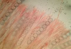 Scutellinia decipiens