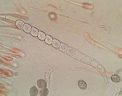 Scutellinia decipiens