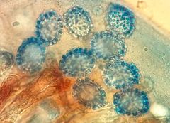 Scutellinia decipiens