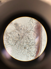 Sarcodiotheca furcata