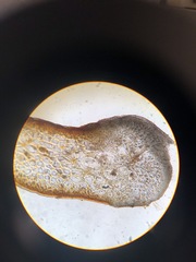 Harveyella mirabilis