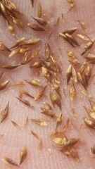 Rhynchospora microcephala