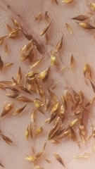 Rhynchospora microcephala