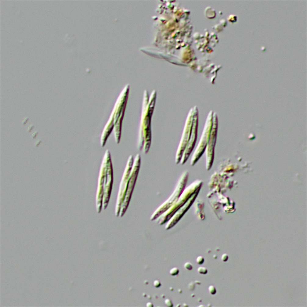 Quadrigula
