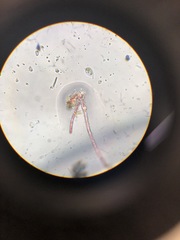 Rhodochorton purpureum