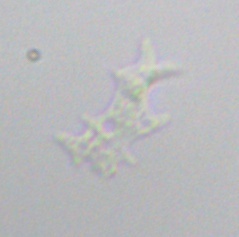 Amoebozoa