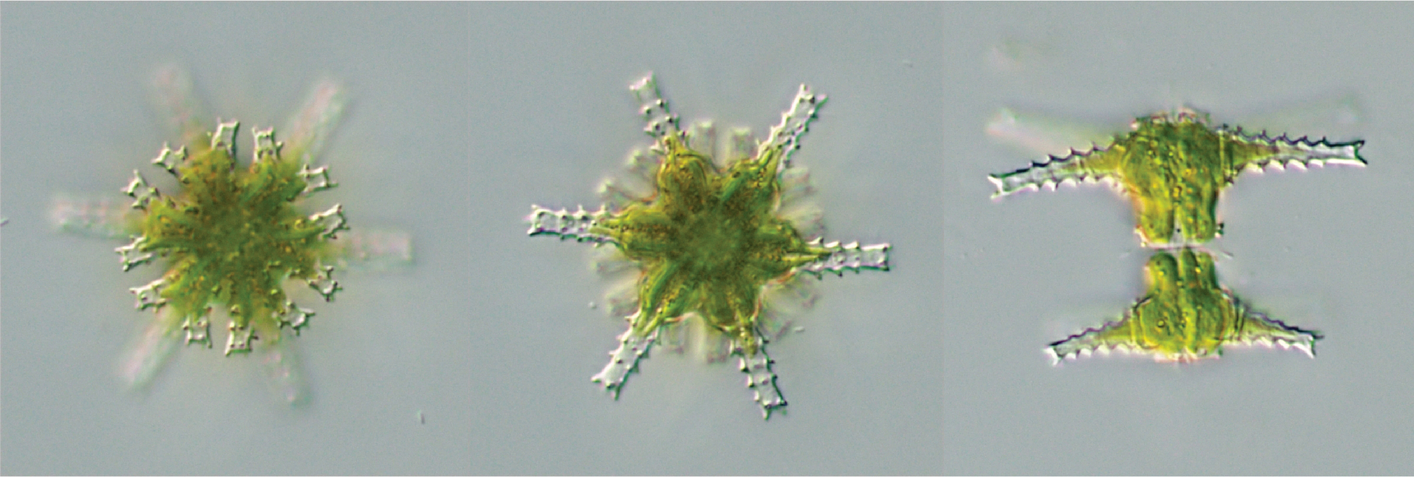 Staurastrum pinnatum