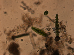 Netrium digitus