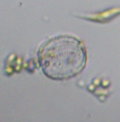 Coscinodiscophycidae