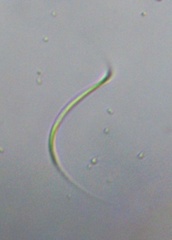 Monoraphidium contortum