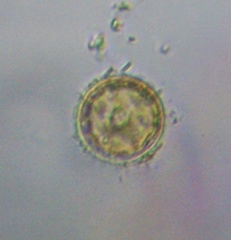 Coscinodiscophycidae