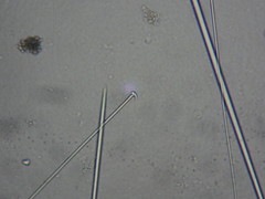 Tetillidae