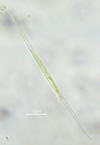 Closterium acutum var. linea