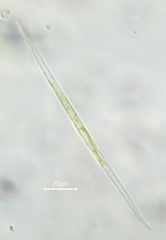 Closterium acutum linea