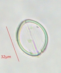 Cocconeis