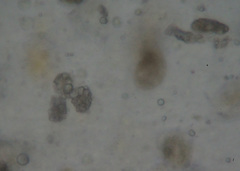 Entomophaga maimaiga