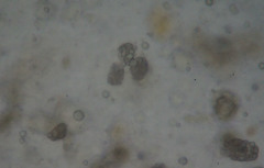 Entomophaga maimaiga