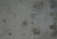 Entomophaga maimaiga