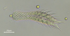 Chaetonotida