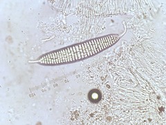 Ocellularia jacinda-arderniae