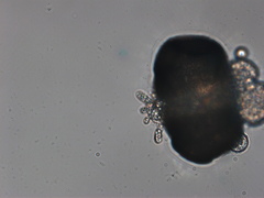 Chytridiomycota