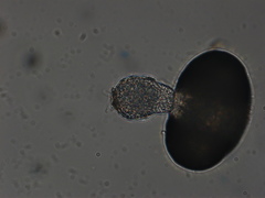 Chytridiomycota