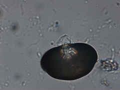 Chytridiomycota