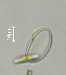 Cocconeis
