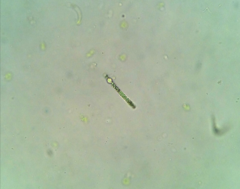 Anabaena