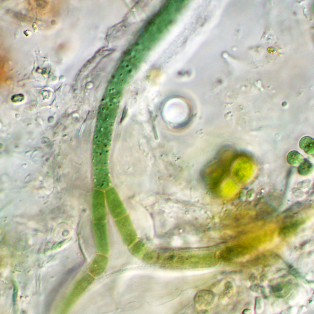 Symphyonema