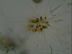 Asterionellopsis glacialis