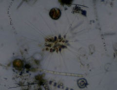 Asterionellopsis glacialis