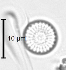 Discostella stelligera