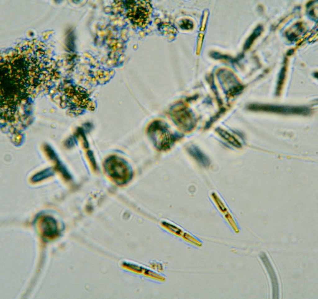Pseudo-nitzschia americana