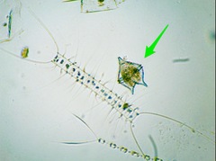 Protoperidinium